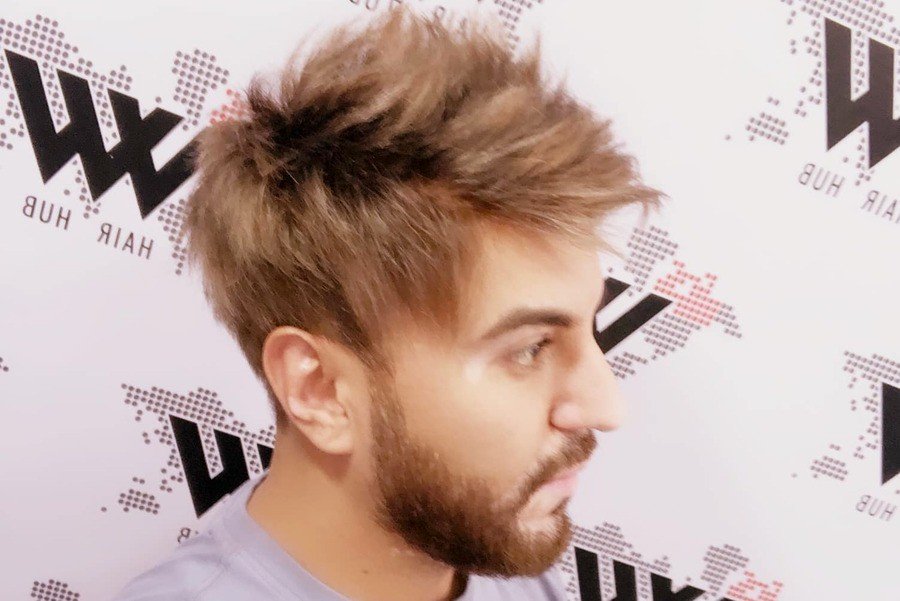 Non-Surgical Hair Fixing: Elevate your Confidence with the Right Hair Patch for Men