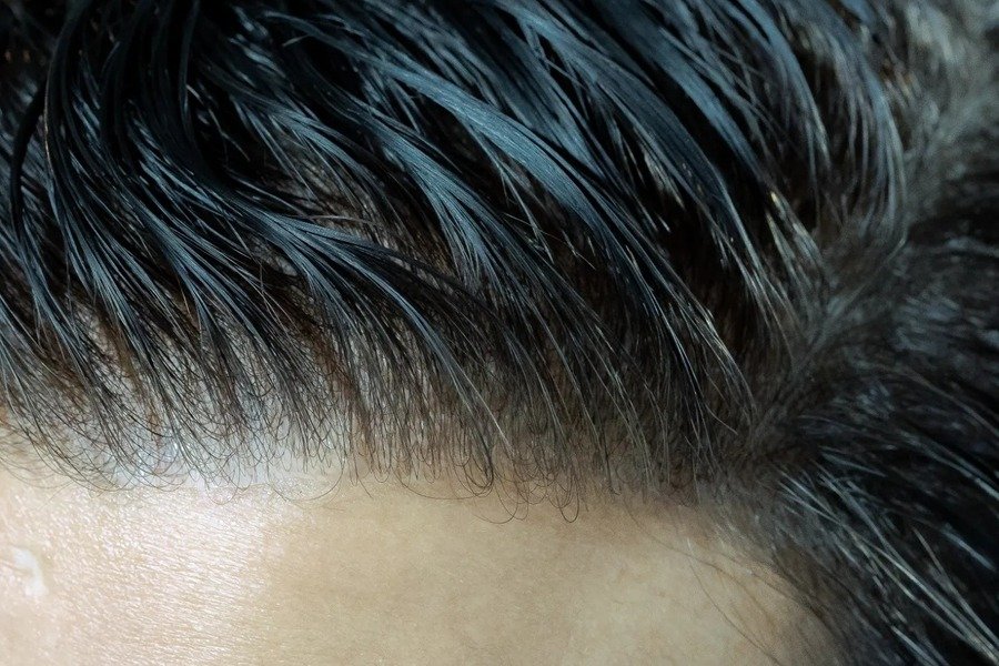 FAQs about Mirage Hair Patch: Everything you need to know