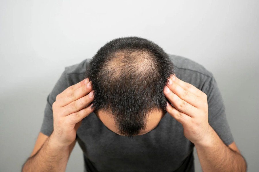 Confidence Begins with Great Hair: Try Our Premium Hair Fixing Services Today